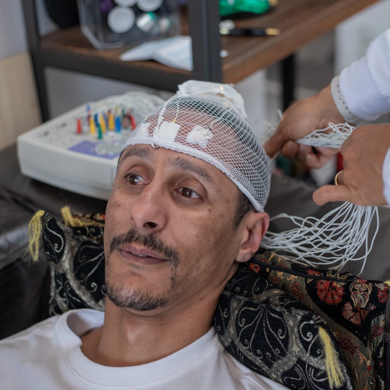 Imagem 010 - Eletroencefalograma (EEG)