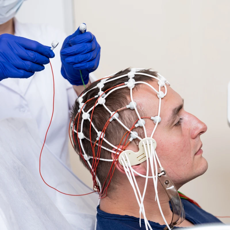 Imagem 012 - Eletroencefalograma (EEG)